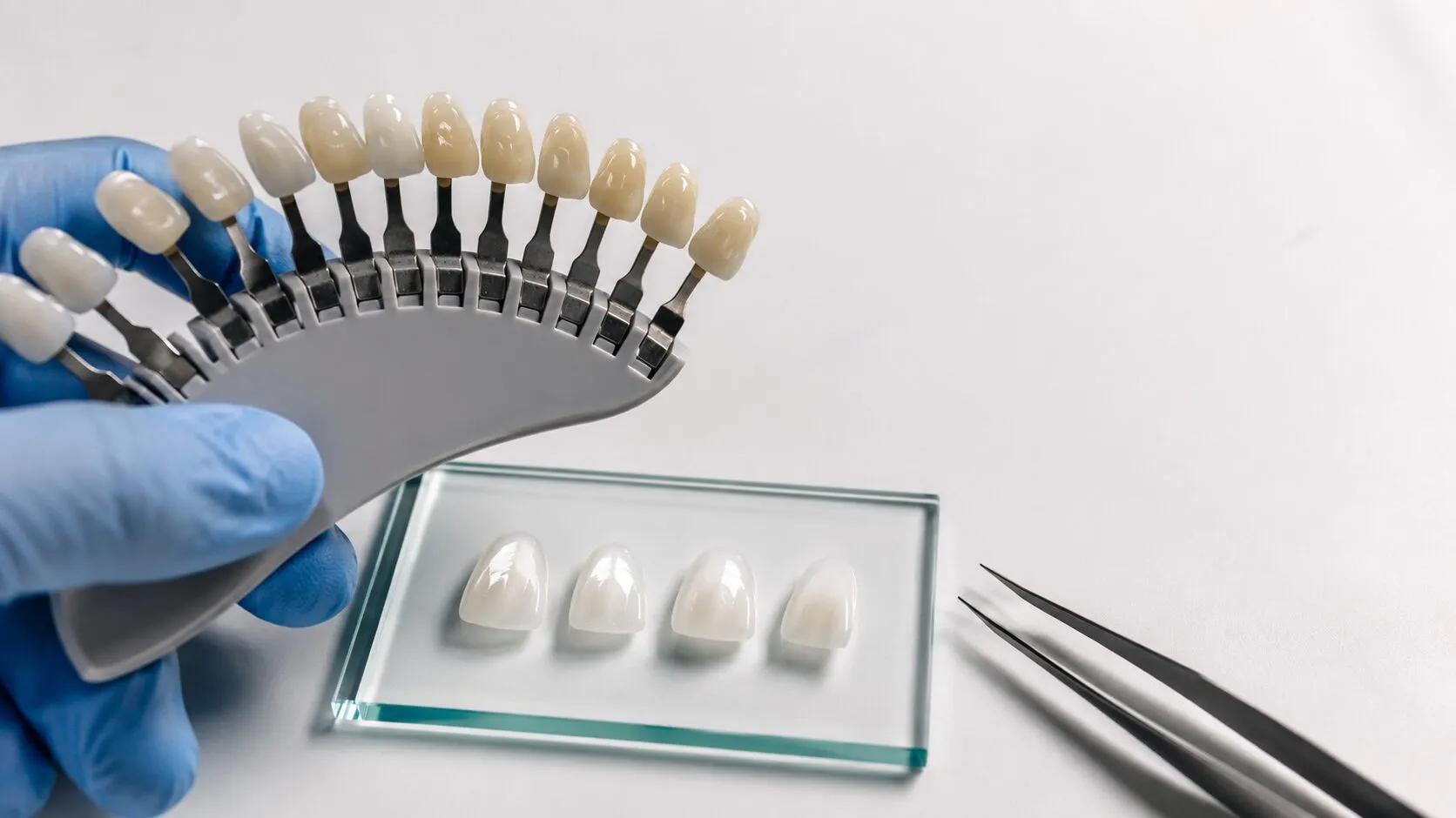 A gloved hand holding a tooth shade guide beside four thin porcelain veneers on a glass tray